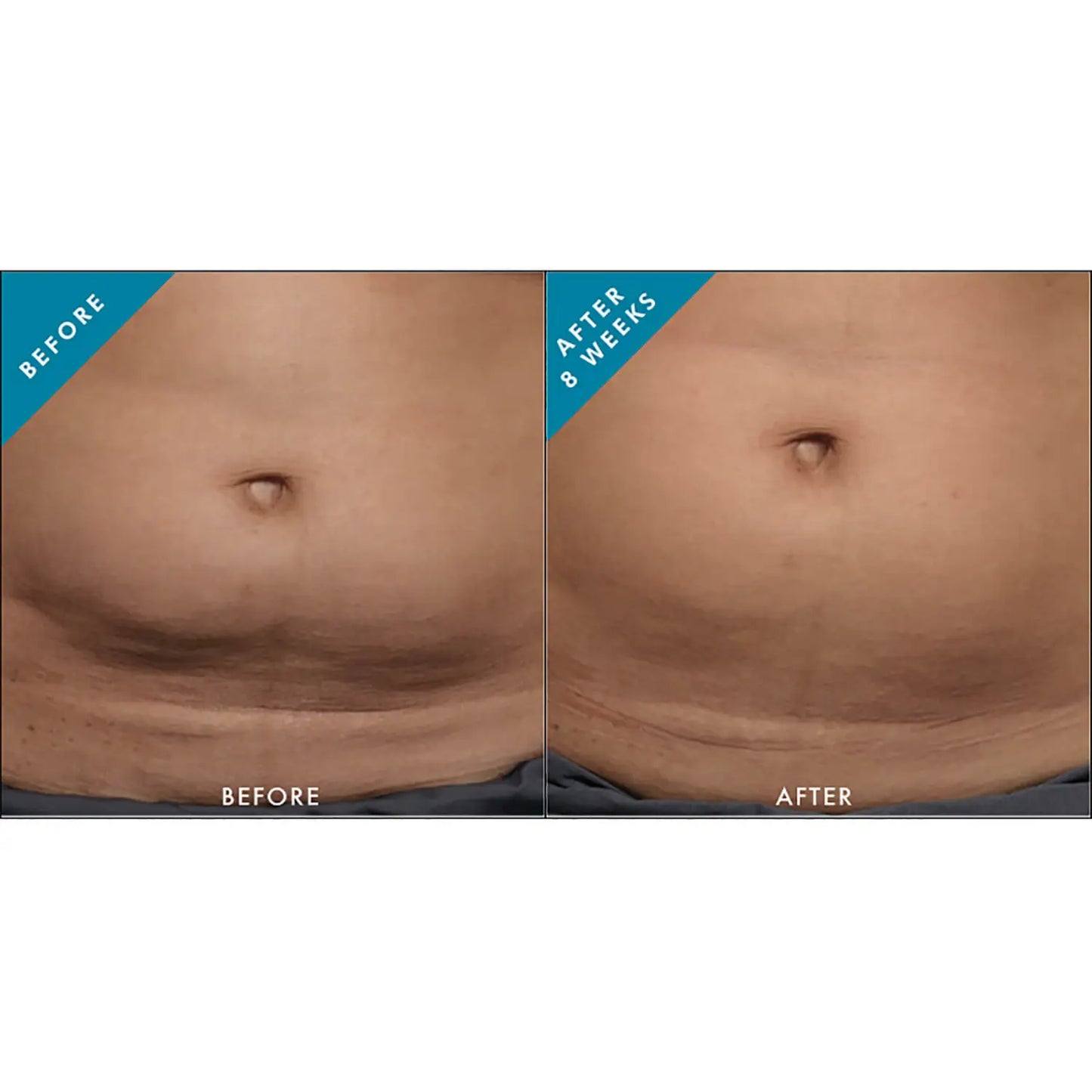 SkinCeuticals Body Tightening Concentrate (5 fl. oz.)