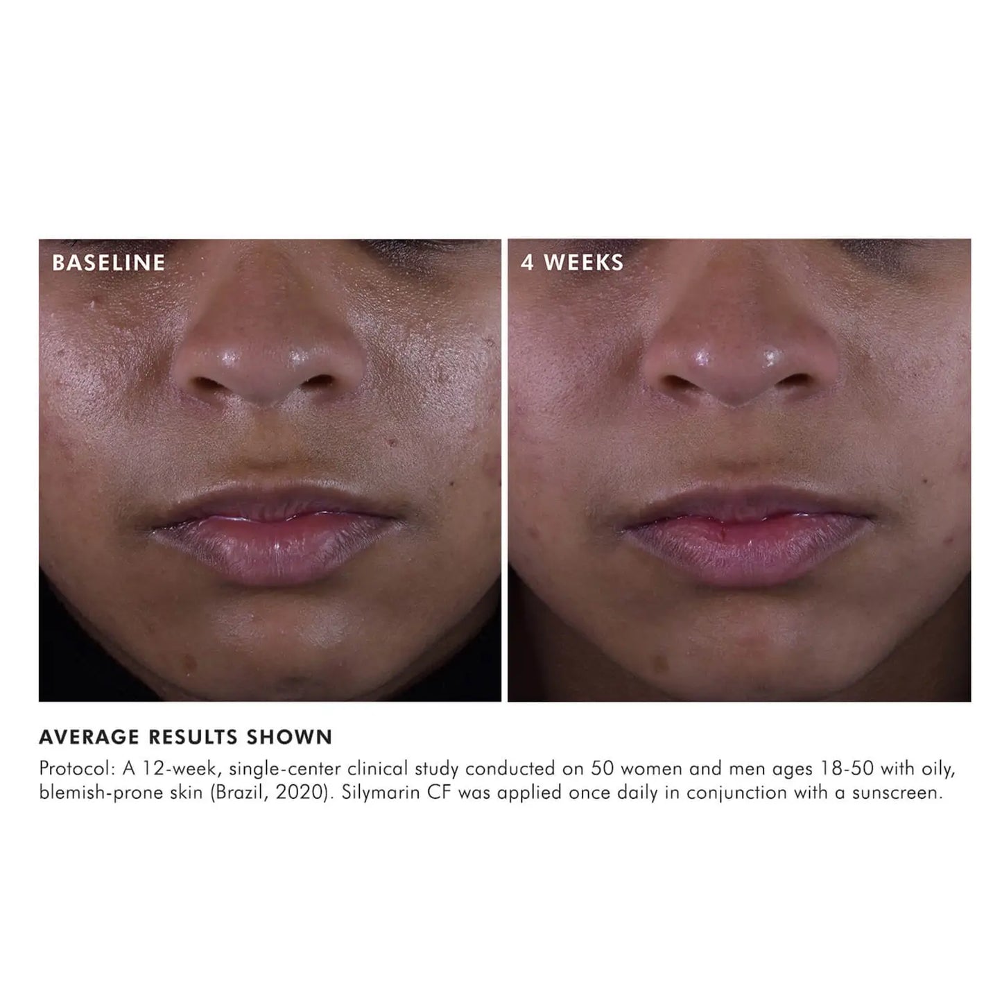 SkinCeuticals Silymarin CF (1 fl. oz.)